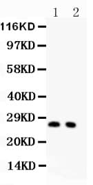 CDKN1B / p27 Kip1 Antibody (aa10-198)