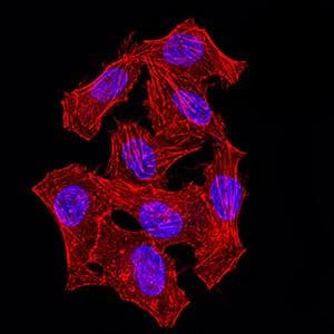 HNRPM / HNRNPM Antibody (clone 5G6C11)
