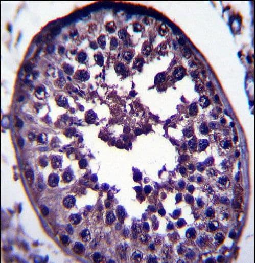GAGE12H Antibody (aa21-49)