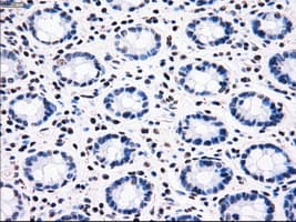 BRAF / B-Raf Antibody (clone OTI3A7)