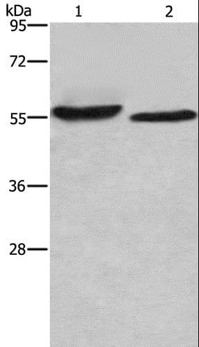 Polyclonal Rabbit anti-Human AMIGO2 Antibody (IHC, WB)