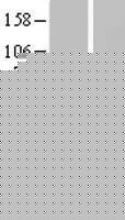 TMEM57 / Macoilin 1 Protein (Over-Expression Lysate Myc-DDK (Flag))