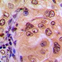 NFKB1 / NF-Kappa-B Antibody (C-Terminus)