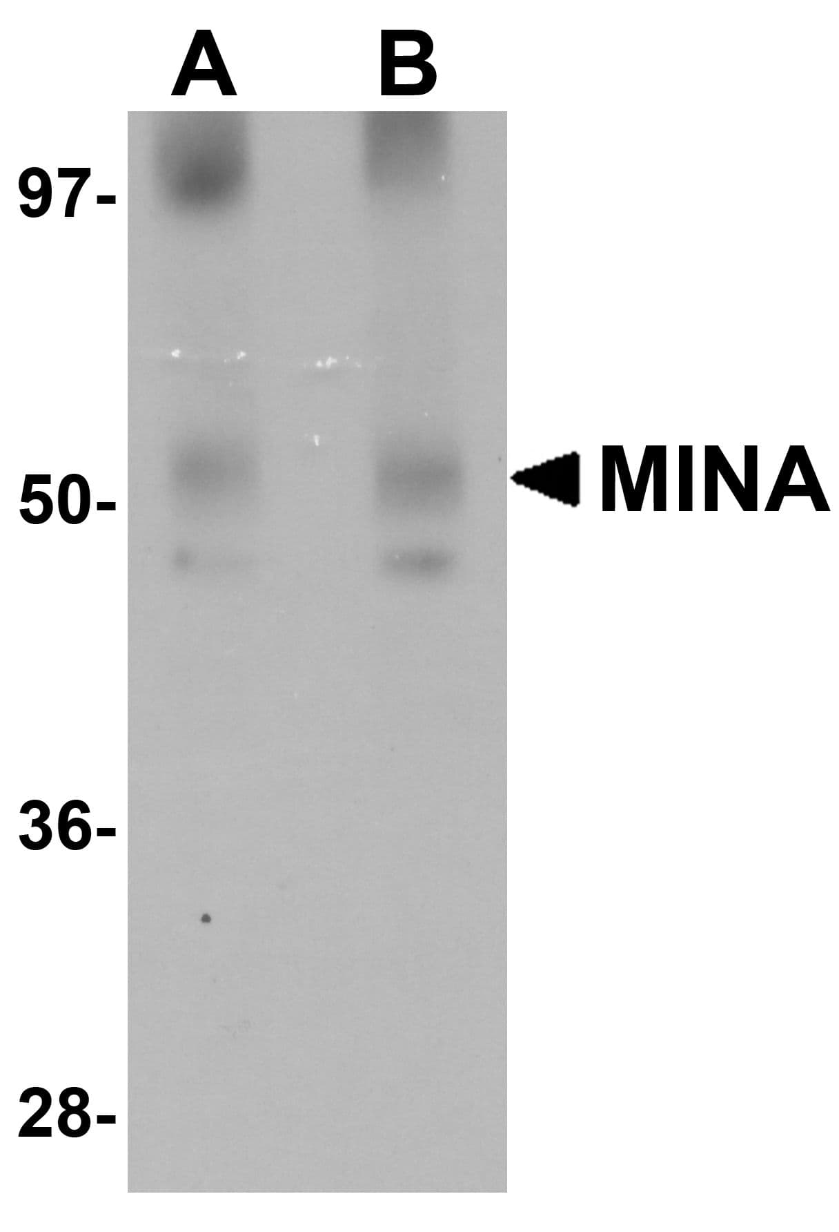 IHC-plus™ Polyclonal Rabbit anti-Human MINA / MINA53 Antibody (IHC, IF, WB)