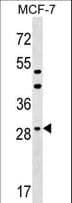 Polyclonal Rabbit anti-Human DHRS11 / MGC4172 Antibody (aa115-142, WB)