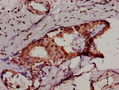 IKBKB / IKK2 / IKK Beta Antibody