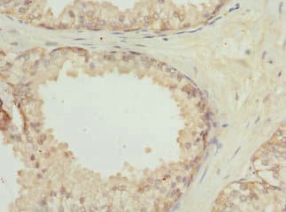 Polyclonal Rabbit anti-Human LGALS8 / Galectin 8 Antibody (IHC)
