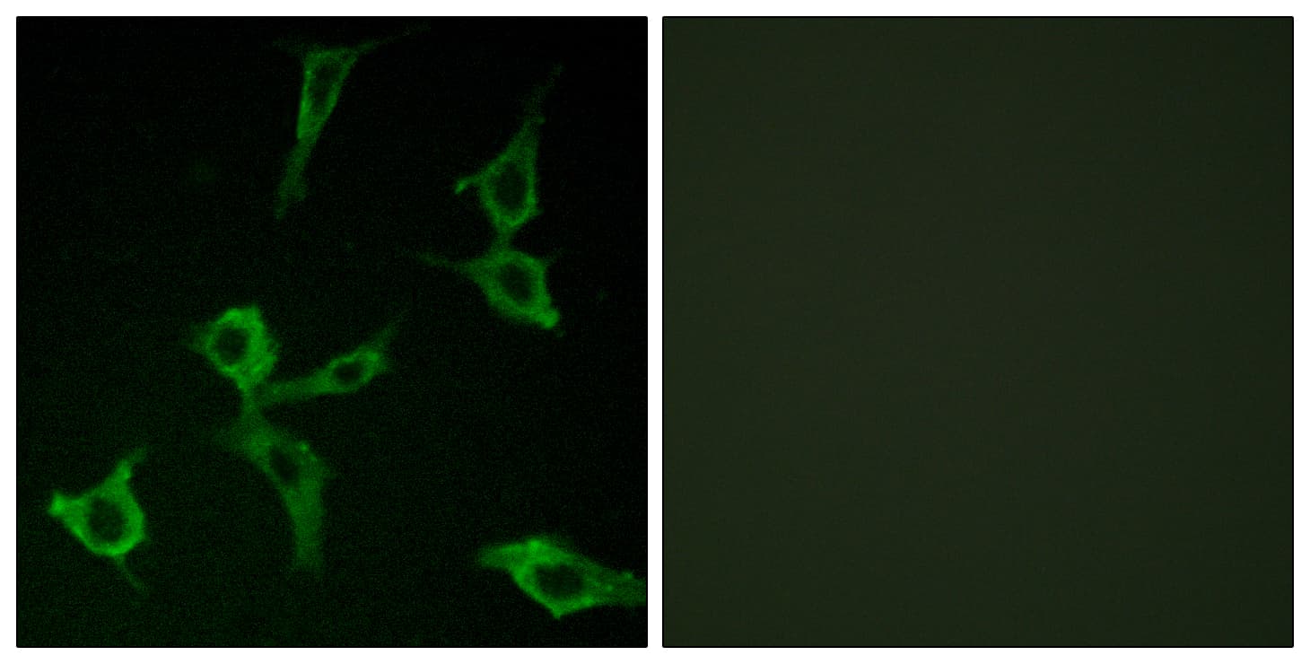 OR2AG1 + OR2AG2 Antibody (Internal)