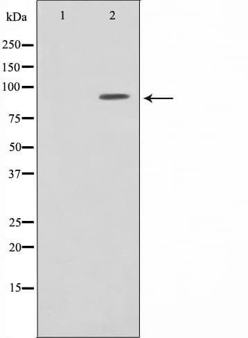 Polyclonal Rabbit anti-Human NR3C1/Glucocorticoid Receptor Antibody (IHC, IF, WB)