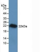 Rat VEGFA / VEGF Protein (Recombinant His, N-Terminal)