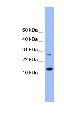 GLRX2 / Glutaredoxin 2 Antibody (aa91-141)