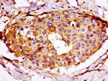 RPS7 / Ribosomal Protein S7 Antibody
