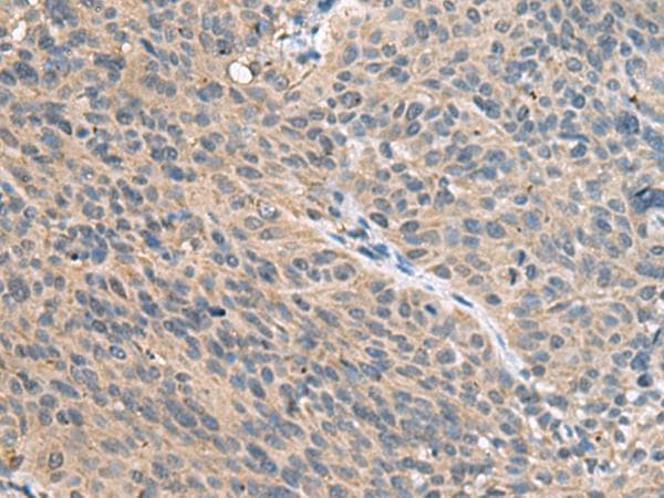 FAM19A4 Antibody