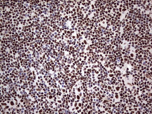 SAE1 Antibody (clone OTI3C3)