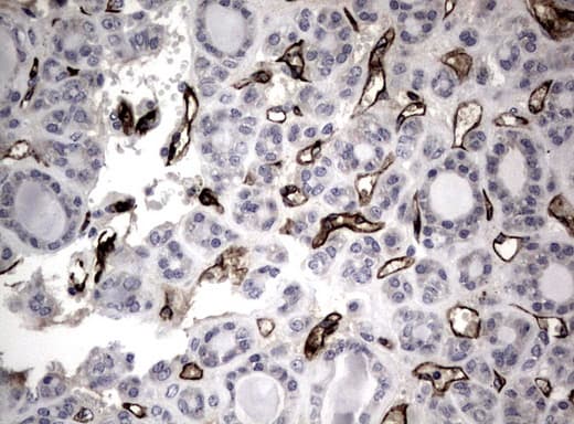 Adiponectin Antibody (aa19-244, clone UMAB104, Carrier-free)