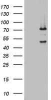 OAS2 Antibody (aa60-335, clone OTI5E1)