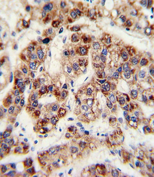 OTC Antibody (aa71-98)