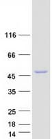 Human ITPK1 Protein (Recombinant Myc-DDK (Flag))