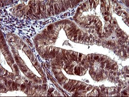 IHC-plus™ TUBB1 / Tubulin Beta 1 Antibody (clone 4A3)