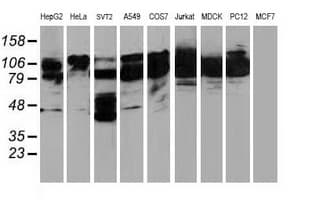 BCAR1 / p130Cas Antibody (clone OTI1B1)