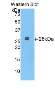 A1BG Antibody (aa22-219, PE)