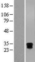 Human HLA-DMA Protein (Over-Expression Lysate Myc-DDK (Flag))