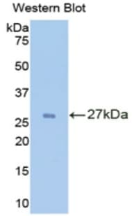 IL2RA / CD25 Antibody (aa24-225, APC)