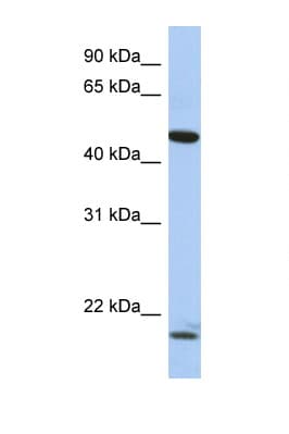 Polyclonal Rabbit anti-Human PLAGL1 / ZAC Antibody (aa71-120, WB)
