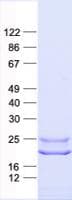 Human GCAP3 / GUCA1C Protein (Recombinant His, N-Terminal)