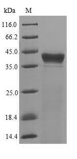 Clostridium botulinum CLPP Protein (Recombinant 6His-SUMO, N-terminus)
