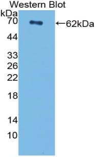 CENPI / CENP-I Antibody (aa321-579)