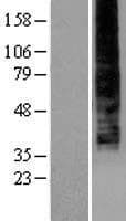 Human LPAR4 / GPR23 Protein (Over-Expression Lysate Myc-DDK (Flag))