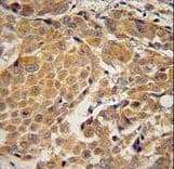 AWAT2 / DGAT2L4 Antibody (aa303-331)