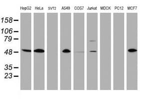 PathPlus™ CD4 Antibody (clone 5D9)