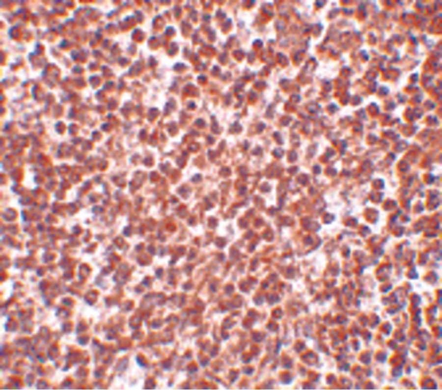 TREX1 Antibody