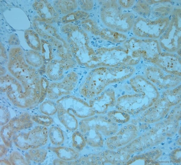 Polyclonal Rabbit anti-Human REEP5 Antibody (aa150-189, IHC)