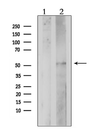 Polyclonal Rabbit anti-Human PTGER4 / EP4 Antibody (IF, WB)