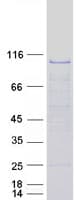 Human OSBPL7 Protein (Recombinant Myc-DDK (Flag))