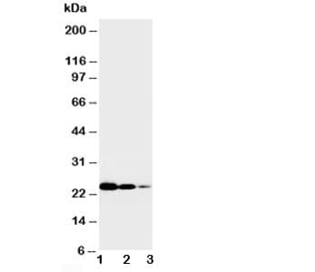TNFRSF1A / TNFR1 Antibody (aa195-211)