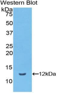 VTN / Vitronectin Antibody (aa19-111)
