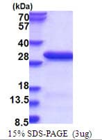 Human RANBP3 Protein (Recombinant His)