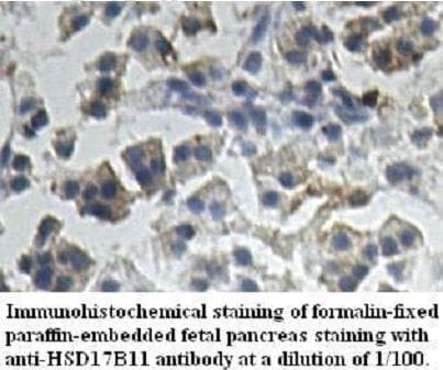 HSD17B11 Antibody (aa38-254)