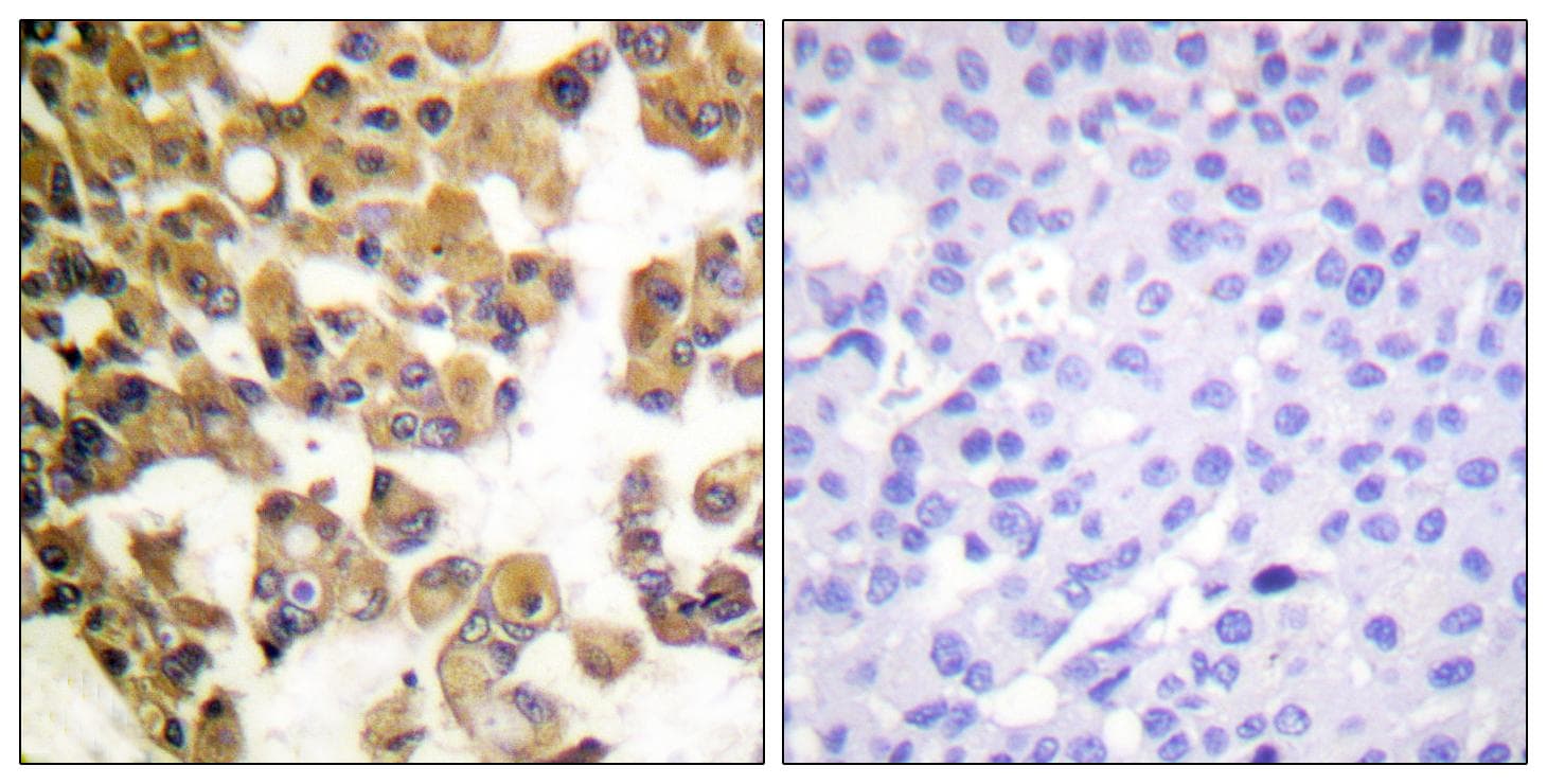 BAD Antibody (Ab-91/128)