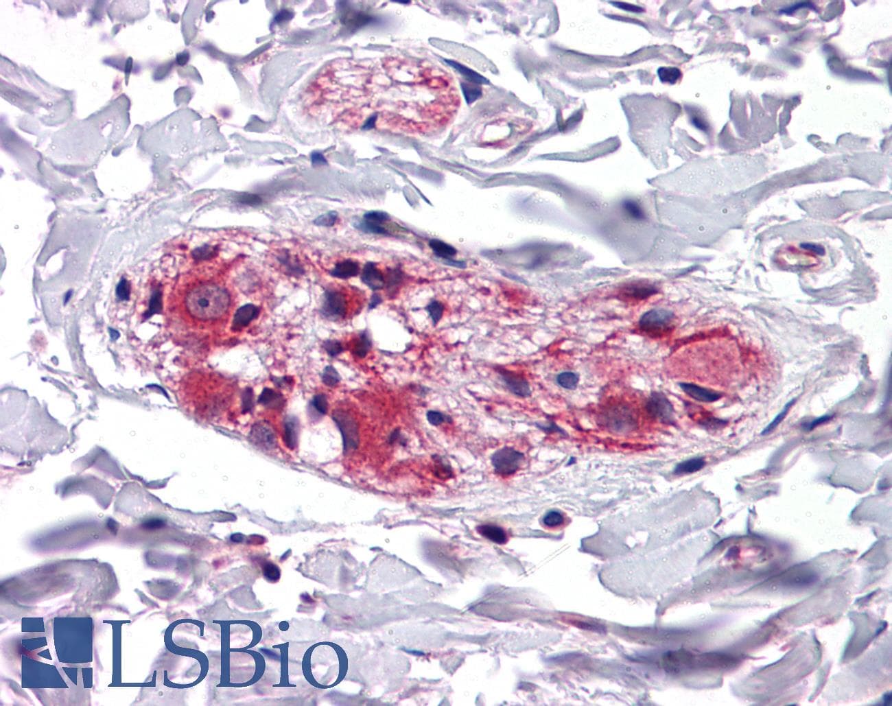 KLHL3 Antibody (aa71-120)