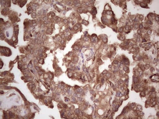 Monoclonal Mouse anti-Human DMN / Desmuslin / Synemin Antibody (clone OTI7H6, aa329-580, IHC, WB)