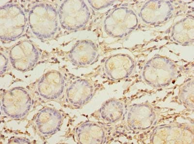 MYADM / Myeloid Marker BM-1 Antibody