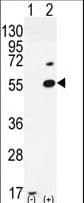 PRMT2 Antibody (aa22-53)