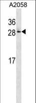 RAB28 Antibody (aa119-147)