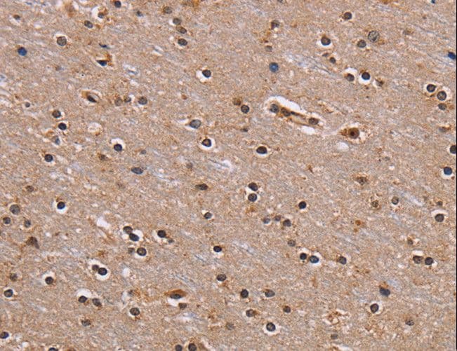 GNL3 / NS / Nucleostemin Antibody