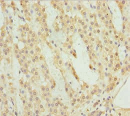 Polyclonal Rabbit anti-Human ACSL6 Antibody (IHC, WB)